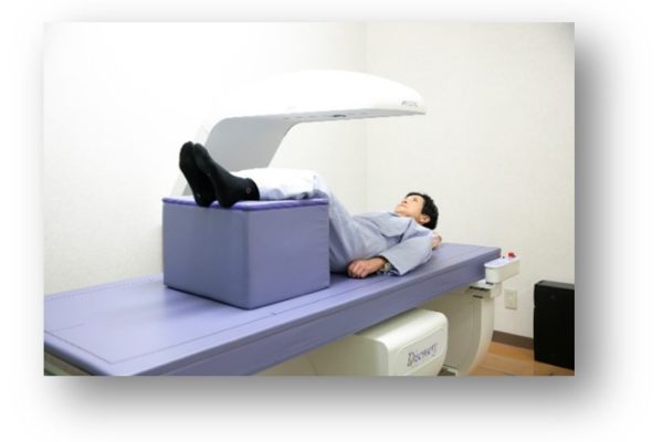 骨密度測定のＱ＆Ａ